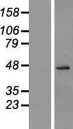 Novus Biologicals&trade;&nbsp;OGG1 Overexpression Lysate