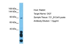 O-GlcNAc Transferase p110 subunit Antibody, Novus Biologicals 0.05mg; Unlabeled:Antibodies,