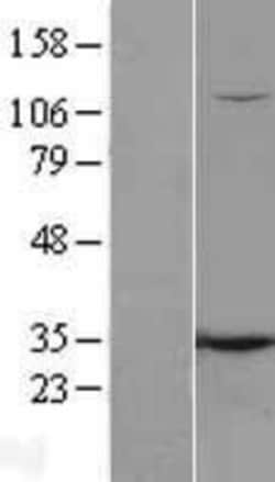 Novus Biologicals™ O-GlcNAc Transferase p110 subunit Overexpression Lysate