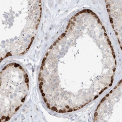 O-GlcNAcase/OGA/MGEA5 Antibody, Novus Biologicals:Antibodies:Primary Antibodies