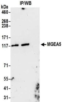 O-GlcNAcase/OGA/MGEA5 Antibody, Novus Biologicals 0.1mg; Unlabeled:Antikroppar