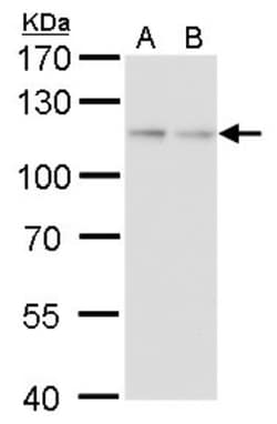 O-GlcNAc Transferase p110 subunit Antibody (2037), Novus Biologicals 0.1mL;