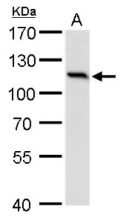 O-GlcNAc Transferase p110 subunit Antibody (2037), Novus Biologicals 0.1mL;