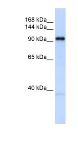 O-GlcNAc Transferase p110 subunit Antibody, Novus Biologicals 0.05mg; Unlabeled:Antibodies,