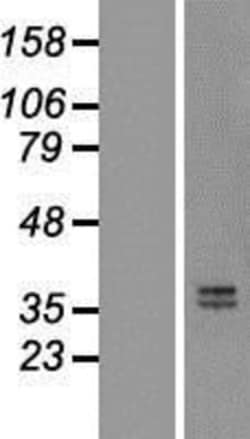 Novus Biologicals&trade;&nbsp;Mimecan/OIF Overexpression Lysate