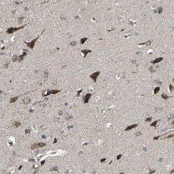 OIP106 Antibody, Novus Biologicals:Antibodies:Primary Antibodies