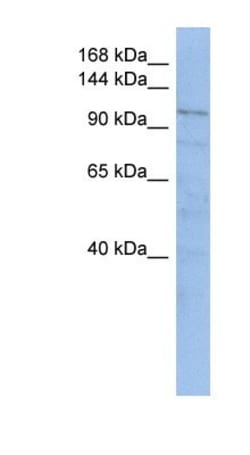 OIP106 Antibody, Novus Biologicals 0.05mg; Unlabeled:Antibodies, Polyclonal