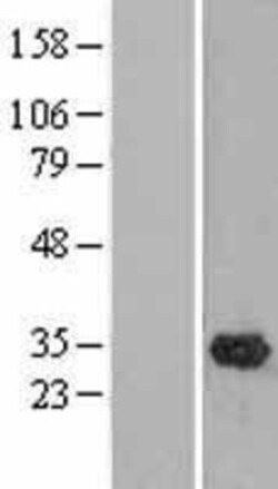 Novus Biologicals™ OLAH Overexpression Lysate