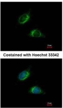 Olfactomedin-1/Noelin-1 Antibody, Novus Biologicals 0.1mg; Unlabeled:Antibodies,