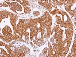 Olfactomedin-1/Noelin-1 Antibody, Novus Biologicals 0.1mg; Unlabeled:Antibodies,