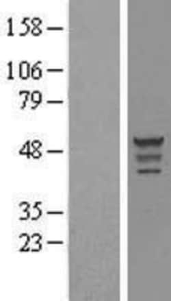 Novus Biologicals&trade;&nbsp;OLFM-L3 Overexpression Lysate