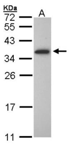 Olig1 Antibody, Novus Biologicals 0.1mg; Unlabeled:Antibodies, Polyclonal