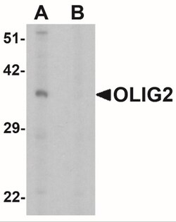 Olig2 Antibody - BSA Free, Novus Biologicals:Antibodies:Primary Antibodies