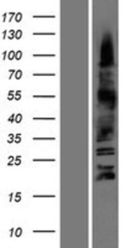 Novus Biologicals&trade;&nbsp;Olig3 Overexpression Lysate