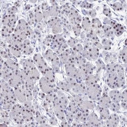 Oncomodulin Antibody, Novus Biologicals 25 &mu;L, Unlabeled:Antibodies,
