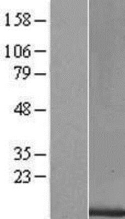 Novus Biologicals&trade;&nbsp;Oncomodulin/OCM2 Overexpression Lysate