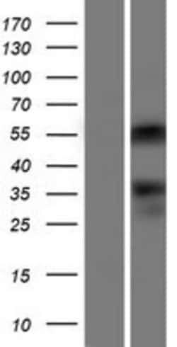 Novus Biologicals&trade;&nbsp;ONECUT2/OC-2 Overexpression Lysate