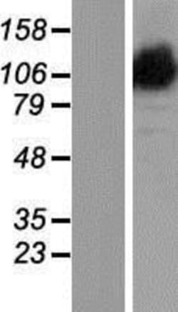 Novus Biologicals&trade;&nbsp;OPA1 Overexpression Lysate