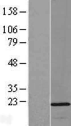 Novus Biologicals™ OPA3 Overexpression Lysate