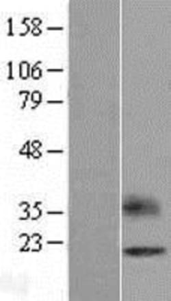 Novus Biologicals™ OPALIN Overexpression Lysate