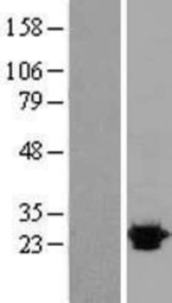 Novus Biologicals&trade;&nbsp;Sigma-1 R/OPRS1 Overexpression Lysate