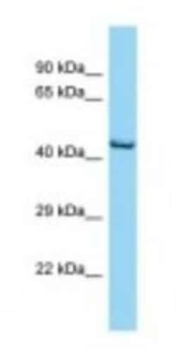 Opsin 1 (Medium Wave) Antibody, Novus Biologicals 100&mu;L; Unlabeled:Antibodies,