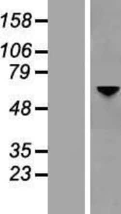 Novus Biologicals&trade;&nbsp;Optineurin Overexpression Lysate