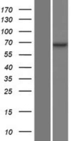 Novus Biologicals&trade;&nbsp;Optineurin Overexpression Lysate