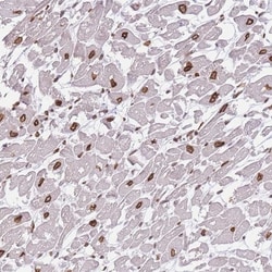 OR10AD1 Antibody, Novus Biologicals 25 &mu;L, Unlabeled:Antibodies, Polyclonal