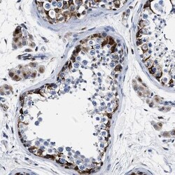 ZNF711 Antibody, Novus Biologicals:Antibodies:Primary Antibodies