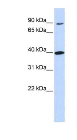 OR11H12 Antibody, Novus Biologicals 100&mu;L; Unlabeled:Antibodies, Polyclonal