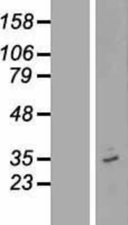 Novus Biologicals&trade;&nbsp;OR12D3 Overexpression Lysate
