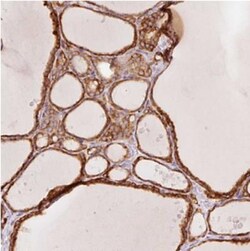 OR13C3 Antibody, Novus Biologicals 25 &mu;L, Unlabeled:Antibodies, Polyclonal