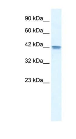 OR13C9 Antibody, Novus Biologicals 100&mu;L; Unlabeled:Antibodies, Polyclonal