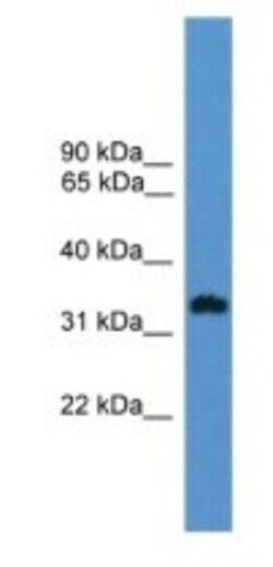OR1L8 Antibody, Novus Biologicals 20&mu;L; Unlabeled:Antibodies, Polyclonal