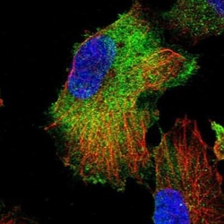 OR1Q1 Antibody, Novus Biologicals 25 &mu;L, Unconjugated:Antibodies, Polyclonal