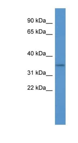 OR2A5 Antibody, Novus Biologicals 100&mu;L; Unlabeled:Antibodies, Polyclonal