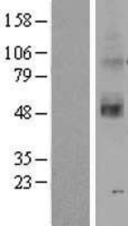 Novus Biologicals&trade;&nbsp;OR2C3 Overexpression Lysate