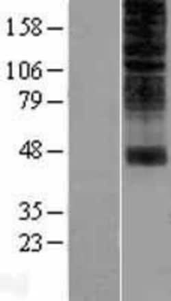 Novus Biologicals&trade;&nbsp;OR2H1 Overexpression Lysate