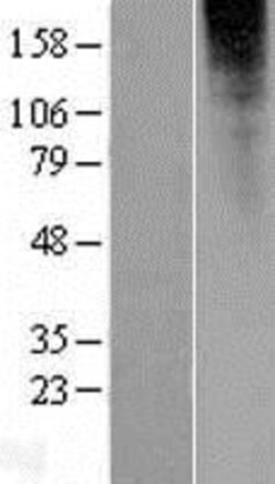 Novus Biologicals&trade;&nbsp;OR2L13 Overexpression Lysate