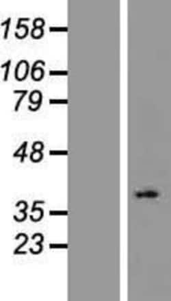 Novus Biologicals&trade;&nbsp;OR2L2 Overexpression Lysate