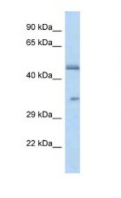 OR2L8 Antibody, Novus Biologicals 100&mu;L; Unlabeled:Antibodies, Polyclonal