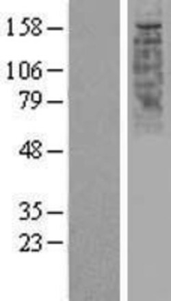 Novus Biologicals&trade;&nbsp;OR2W1 Overexpression Lysate
