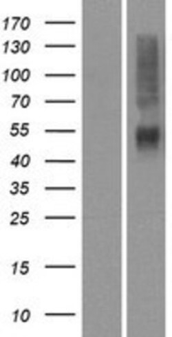 Novus Biologicals&trade;&nbsp;OR4K14 Overexpression Lysate