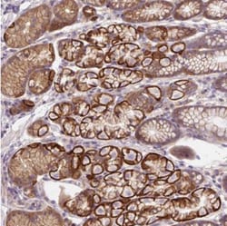OR4K15 Antibody, Novus Biologicals:Antibodies:Primary Antibodies