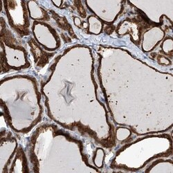 TBRG4 Antibody, Novus Biologicals:Antibodies:Primary Antibodies