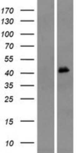 Novus Biologicals&trade;&nbsp;OR4M1 Overexpression Lysate