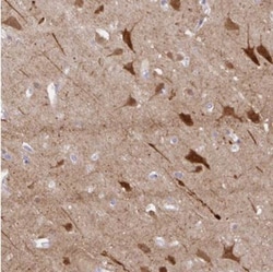 OR4N4 Antibody, Novus Biologicals 0.1mL; Unlabeled:Antibodies, Polyclonal