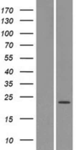Novus Biologicals&trade;&nbsp;OR4X1 Overexpression Lysate