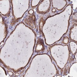 OR52I2 Antibody, Novus Biologicals:Antibodies:Primary Antibodies